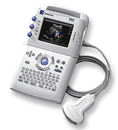 портативная ультразвуковая система SonoSite-180 PLUS